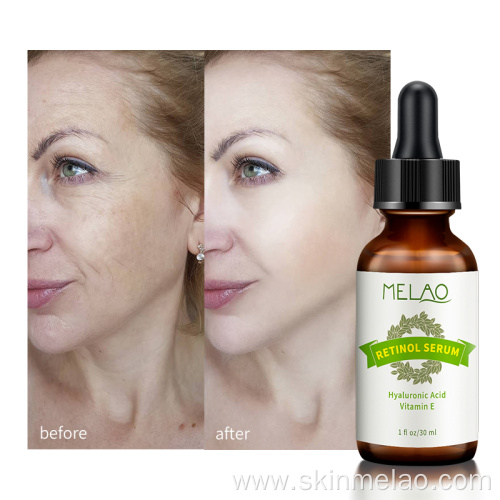 Skin Care Pure Organic Retinol Serum